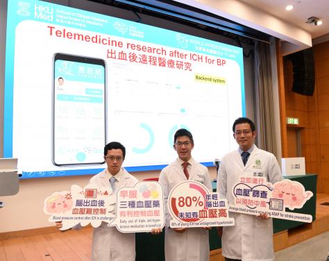 HKUMed has developed the ‘TRICH score’, an innovative clinical tool to help physicians effectively identify intracerebral hemorrhage patients who may benefit from early triple anti-hypertensive treatment. Pictured from right: Dr Teo Kay-cheong, Dr Gary Lau Kui-kai and Adrian So Ching-hei.
 